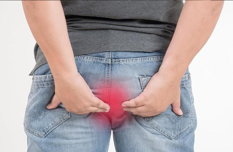 Cirugía Hemorroides, fístulas, abscesos y fisuras anales en Lima
